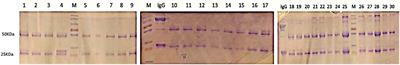 Distinct N-Linked Immunoglobulin G Glycosylation Patterns Are Associated With Chronic Pathology and Asymptomatic Infections in Human Lymphatic Filariasis